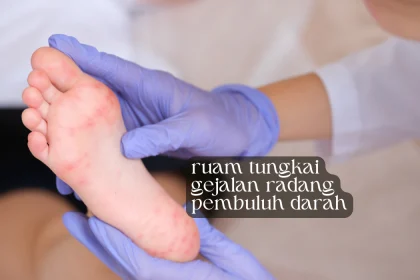 ruam tungkai gejala pembuluh darah